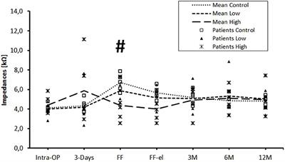 Dose-Dependent Transient Decrease of Impedances by Deep Intracochlear Injection of Triamcinolone With a Cochlear Catheter Prior to Cochlear Implantation–1 Year Data